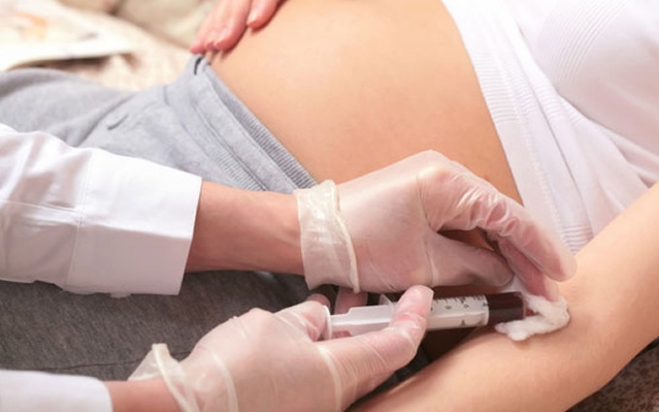 Diagnosi prenatale non invasiva